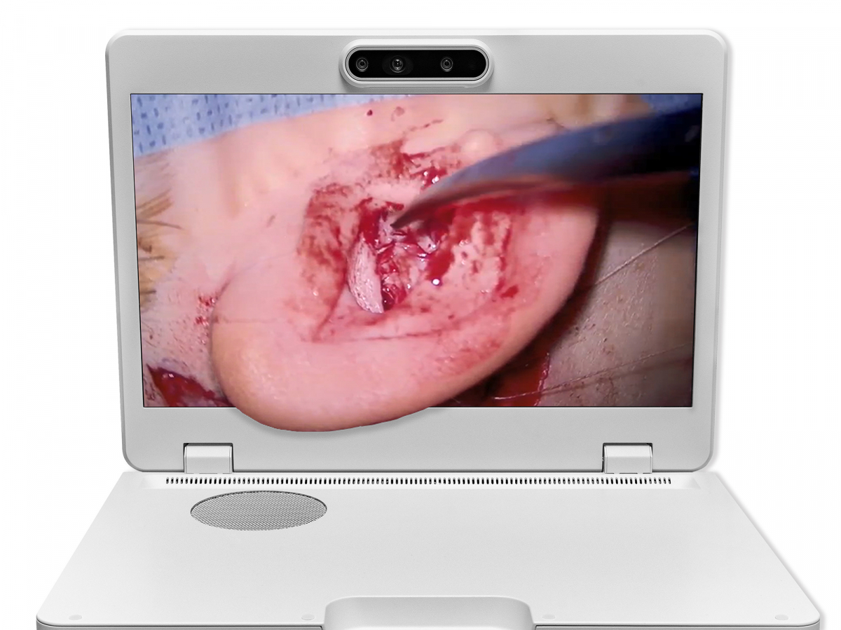 达擎之＂Heads-up 3D显微手术显示系统＂，整合4K裸眼3D显示及眼球追踪系统，具备快速追踪人眼移动位置功能，减轻医师长时间维持固定姿势的负担，让医师能有更宽广清晰的3D立体视野及更舒适的姿势来执行手术。